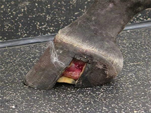 Keratoma treatment 1